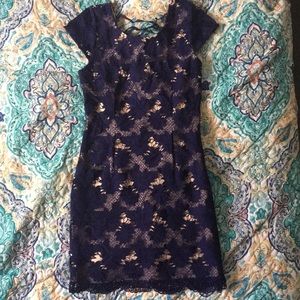 Soeiblu Lace Summer Dress 🌞